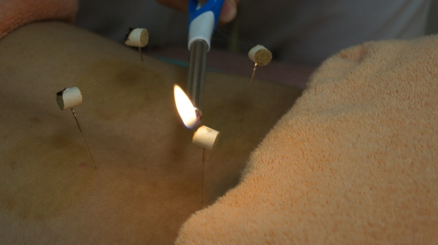 일본 침구원 이미지